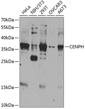 Anti-CENPH Polyclonal Antibody (CAB8372)