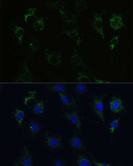 Anti-STX1A Antibody (CAB5570)