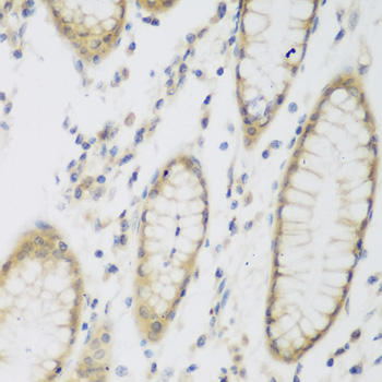 Anti-NAT8B Antibody (CAB7203)