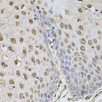 Anti-Cyclin A2 Antibody (CAB2891)