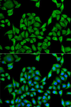 Anti-UGT1A1 Antibody (CAB6186)