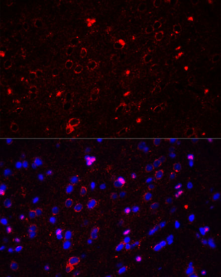 Anti-GRIN2A Antibody (CAB13863)