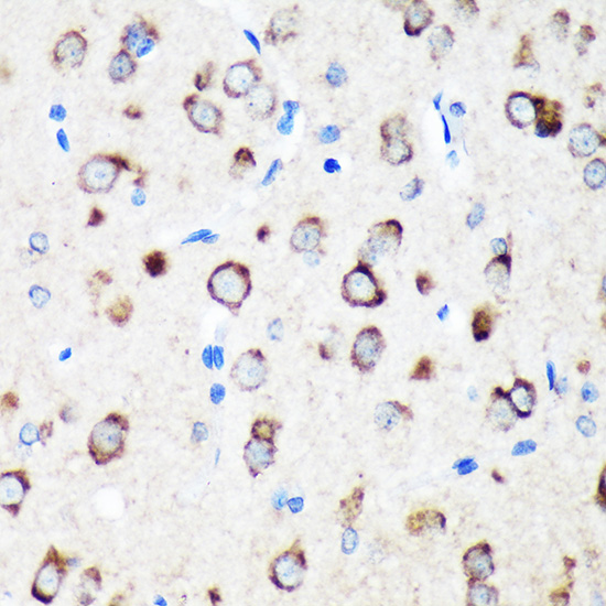 Anti-TXNDC12 Antibody (CAB14403)