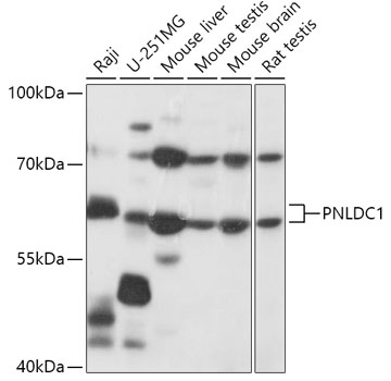 Anti-PNLDC1 Antibody (CAB17838)