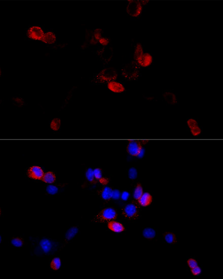 Anti-FLNB Antibody (CAB2481)