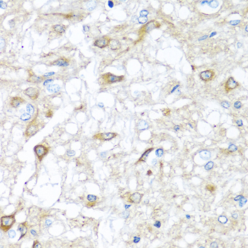 Anti-RAC2 Antibody (CAB1139)