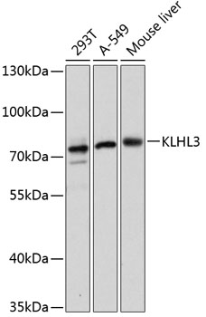 Anti-KLHL3 Antibody (CAB13771)