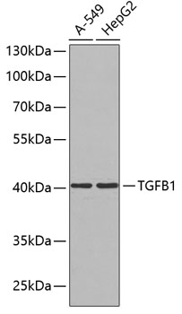 Anti-TGFB1 Mouse Monoclonal Antibody (CAB0291)