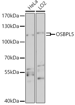 Anti-OSBPL5 Antibody (CAB18148)