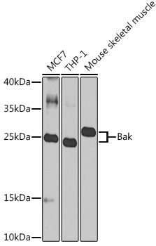 Anti-Bak Antibody (CAB0498)