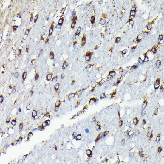 Anti-TTC11 Antibody [KO Validated] (CAB19666)