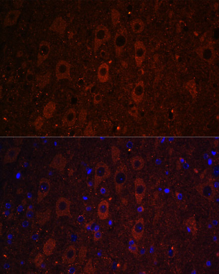 Anti-RUSC1 Antibody (CAB15417)