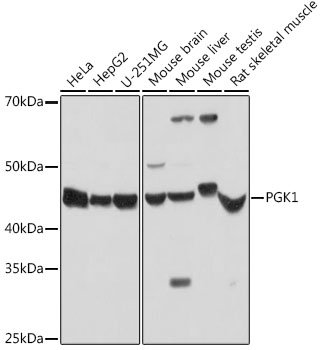 Anti-PGK1 Antibody (CAB14039)