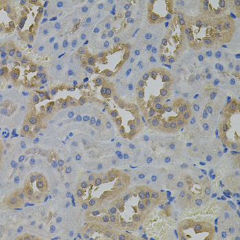 Anti-ARF1 Antibody (CAB2821)