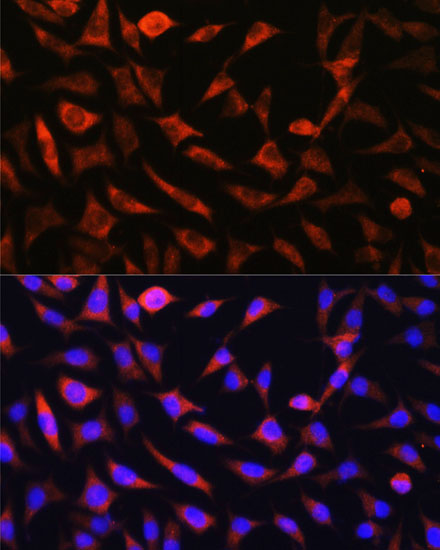 Anti-SLC25A22 Antibody [KO Validated] (CAB17772)