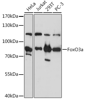 Anti-FoxO3a Antibody (CAB0102)