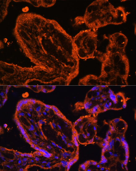 Anti-LDB3 Antibody (CAB7462)