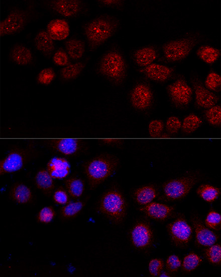 Anti-CXCR4 Antibody (CAB15112)