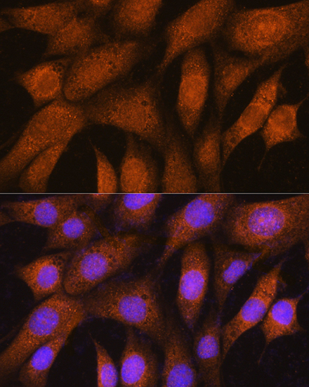 Anti-GSTT2B Antibody (CAB15583)