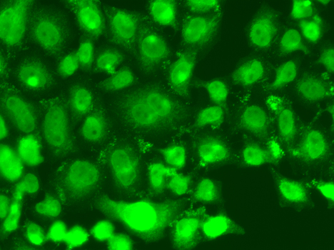 Anti-TSEN2 Antibody (CAB7838)