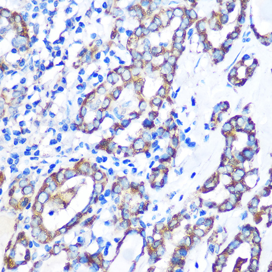 Anti-STK26 Antibody (CAB16534)