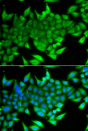 Anti-TTF2 Antibody (CAB7751)