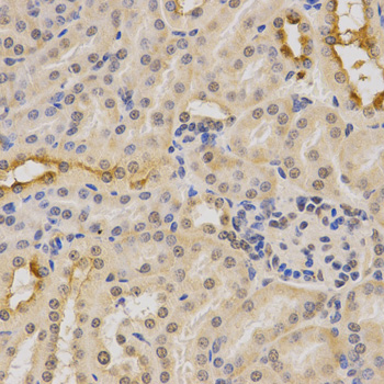 Anti-PDHA1 Antibody (CAB13525)