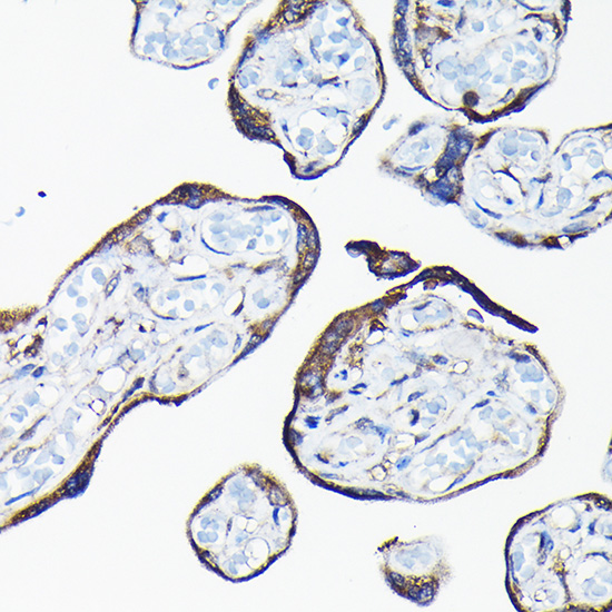 Anti-CYP1A1 Antibody (CAB2159)