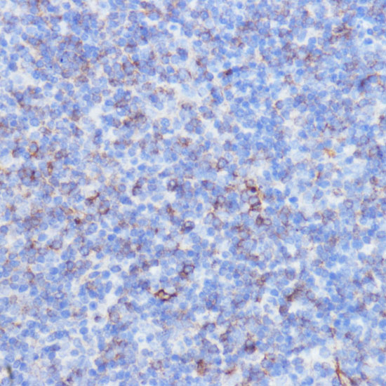 Anti-NOTCH3 Antibody (CAB13522)