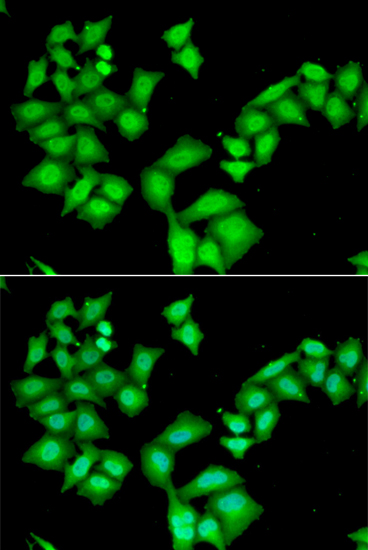 Anti-AAAS Antibody (CAB6427)