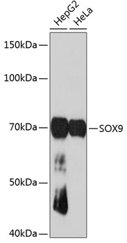 Anti-SOX9 Antibody (CAB19710)