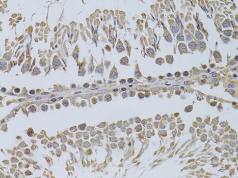 Anti-P2RY2 Antibody (CAB13923)