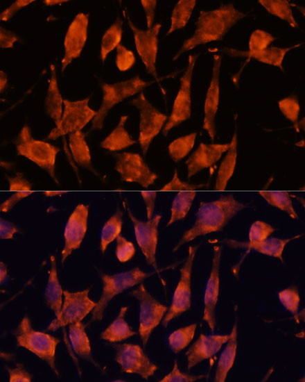 Anti-XPNPEP3 Antibody (CAB14919)