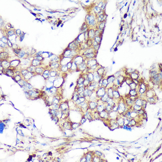 Anti-CAND2 Antibody (CAB16500)