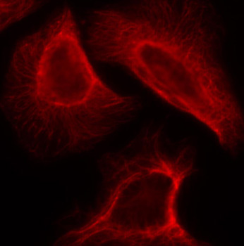 Anti-Phospho-RPS6KB1-S424 Antibody (CABP0253)