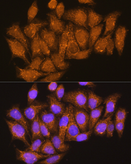 Anti-ATP6V1E1 Antibody (CAB3756)