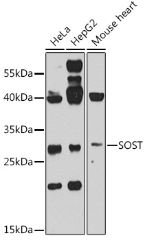 Anti-Sclerostin Polyclonal Antibody (CAB8213)