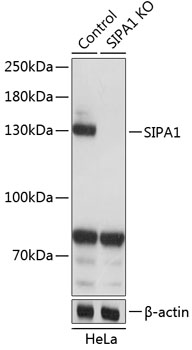 Anti-SIPA1 Antibody [KO Validated] (CAB19867)