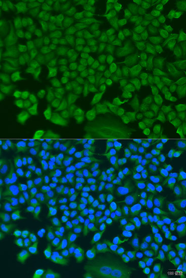 Anti-HS1BP3 Polyclonal Antibody (CAB8250)