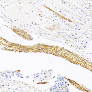 Anti-VASH1 Antibody (CAB12569)