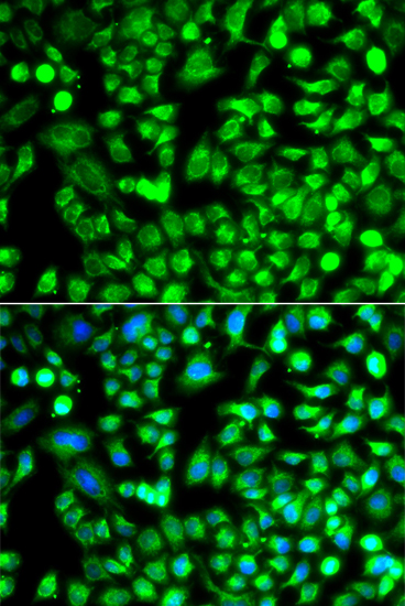 Anti-ALKBH4 Antibody (CAB12593)