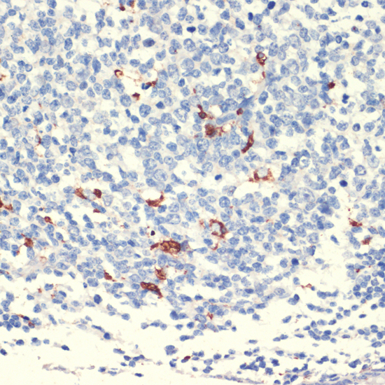 Anti-CD68 Antibody (CAB6554)