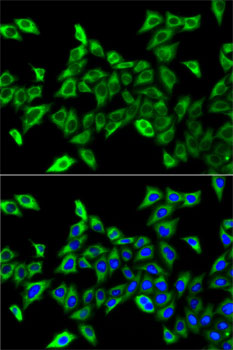 Anti-HADHA Antibody (CAB13310)