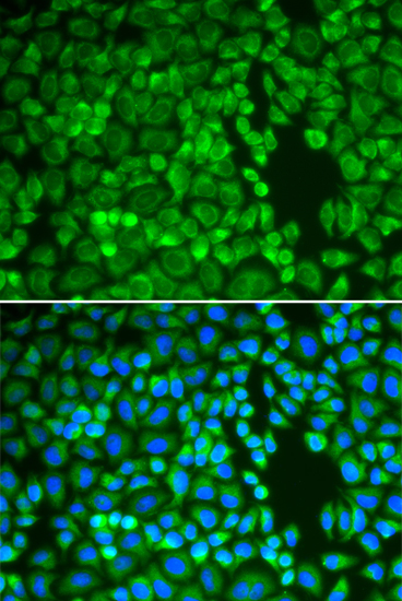 Anti-IDE Antibody [KO Validated] (CAB1630)