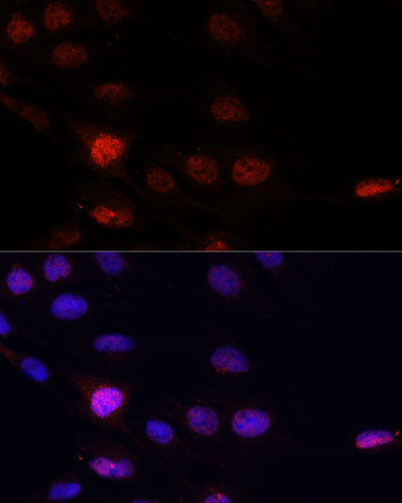 Anti-KLHL8 Antibody (CAB14917)