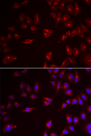 Anti-PRAME Antibody (CAB6456)