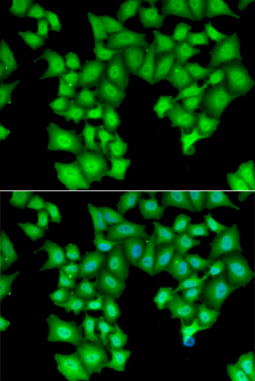 Anti-CPSF3L Antibody (CAB6566)