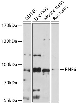 Anti-RNF6 Antibody (CAB14572)