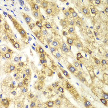 Anti-CTBP1 Antibody (CAB1707)