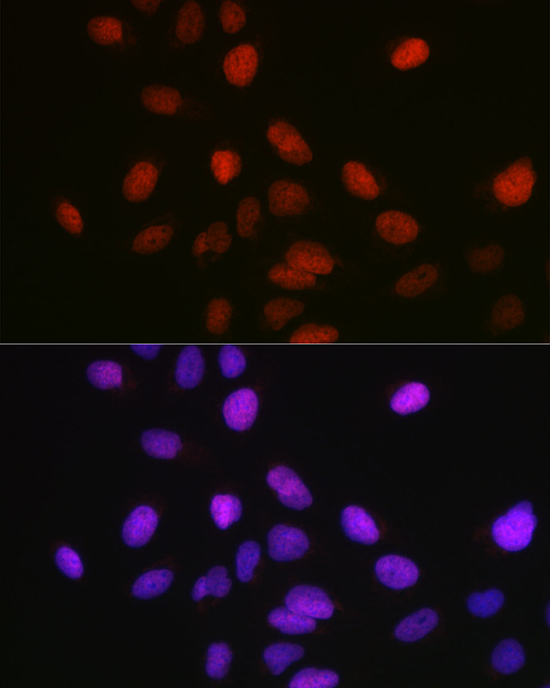 Anti-SETD8 Antibody (CAB5256)